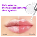 SpiculeShot – Lip Plumper Com Tecnologia Coreana Que Aumenta o Volume e Deixa Efeito Preenchido (Oferta Exclusiva)